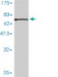 SAE1 Antibody (monoclonal) (M01)