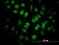 SAFB Antibody (monoclonal) (M04)