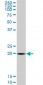 SAR1A Antibody (monoclonal) (M01)