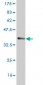 SCN8A Antibody (monoclonal) (M04)