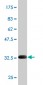 SCN9A Antibody (monoclonal) (M01)