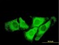 SCYE1 Antibody (monoclonal) (M02)