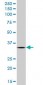 SCYE1 Antibody (monoclonal) (M05)