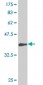 SDHC Antibody (monoclonal) (M01)