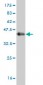 SDHC Antibody (monoclonal) (M02)
