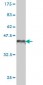 SEMA4D Antibody (monoclonal) (M01)