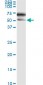 SERPINA3 Antibody (monoclonal) (M01)