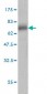 SERPINA3 Antibody (monoclonal) (M01)