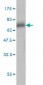 SERPINA3 Antibody (monoclonal) (M01)