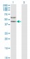 SERPINA3 Antibody (monoclonal) (M01)