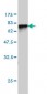 SERPINA6 Antibody (monoclonal) (M02)