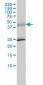 SERPINA6 Antibody (monoclonal) (M02)