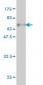 SERPINA6 Antibody (monoclonal) (M04)