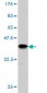 SERPINB3 Antibody (monoclonal) (M01)