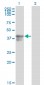 SERPINB3 Antibody (monoclonal) (M01)
