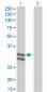 SERPINC1 Antibody (monoclonal) (M02)