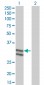 SERPINC1 Antibody (monoclonal) (M02)