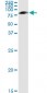 SERPING1 Antibody (monoclonal) (M01)