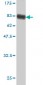 SERPING1 Antibody (monoclonal) (M01)