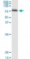 SERPING1 Antibody (monoclonal) (M01)