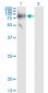 SERPING1 Antibody (monoclonal) (M01)