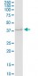 SERPINH1 Antibody (monoclonal) (M01)