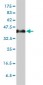 SERPINH1 Antibody (monoclonal) (M01)