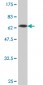 SERPINI1 Antibody (monoclonal) (M03)