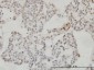 SESN2 Antibody (monoclonal) (M03)