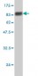 SESN2 Antibody (monoclonal) (M03)