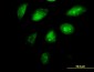 SETDB1 Antibody (monoclonal) (M07)