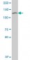 SETDB1 Antibody (monoclonal) (M07)