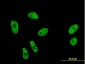 SF1 Antibody (monoclonal) (M01)