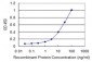 SFMBT1 Antibody (monoclonal) (M02)