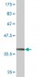 SFMBT1 Antibody (monoclonal) (M02)