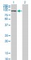 SFMBT1 Antibody (monoclonal) (M02)