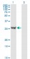 SFN Antibody (monoclonal) (M01)