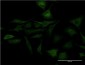 SFN Antibody (monoclonal) (M02)