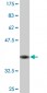 SFXN3 Antibody (monoclonal) (M01)