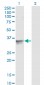 SFXN3 Antibody (monoclonal) (M01)