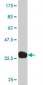 SGCB Antibody (monoclonal) (M02)