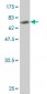 SGK Antibody (monoclonal) (M01)