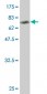 SGK Antibody (monoclonal) (M01)