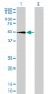 SGK Antibody (monoclonal) (M01)