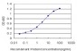 SGK2 Antibody (monoclonal) (M05)