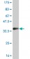 SGK2 Antibody (monoclonal) (M05)