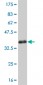 SGK2 Antibody (monoclonal) (M07)