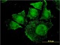 SGK2 Antibody (monoclonal) (M08)