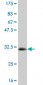 SGK2 Antibody (monoclonal) (M08)