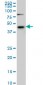 SGK2 Antibody (monoclonal) (M08)